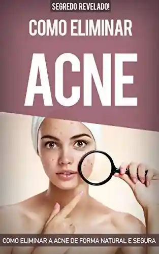 Livro Baixar: Acne: Como Eliminar a Acne de forma natural e segura sem precisar de tratamentos caros, eliminando todas as espinhas e conseguindo uma pele saudável. Cure a acne em 31 dias ou menos.