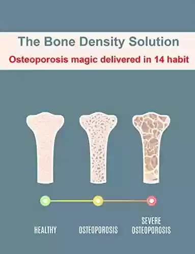 Livro Baixar: The Bone Density Solution: Osteoporosis magic delivered in 14 habit (English Edition)
