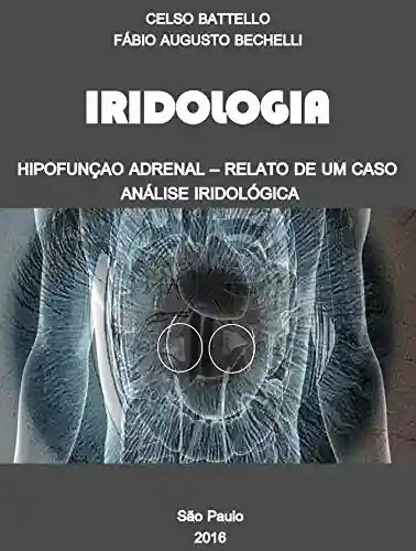 Livro Baixar: Iridologia – Hipofunção Adrenal: Relato de um Caso – Análise Iridológica